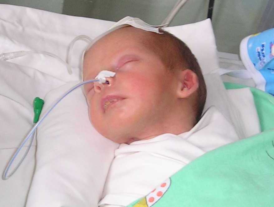 08  8 29  Robert sleeping in Neotatal Intensive Care Unit CRPD  P8290003